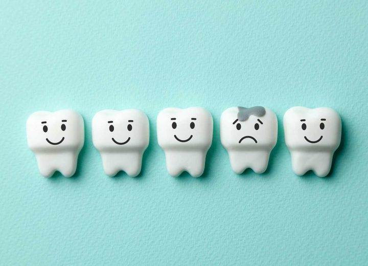 dental-restoration-caries-opt